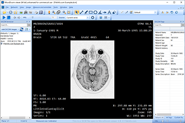 Screenshot of a .dcm file in MicroDicom viewer 3.8